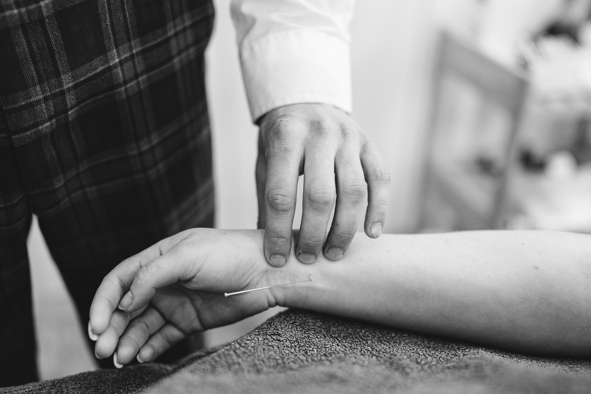 Acupuncture needle insertion