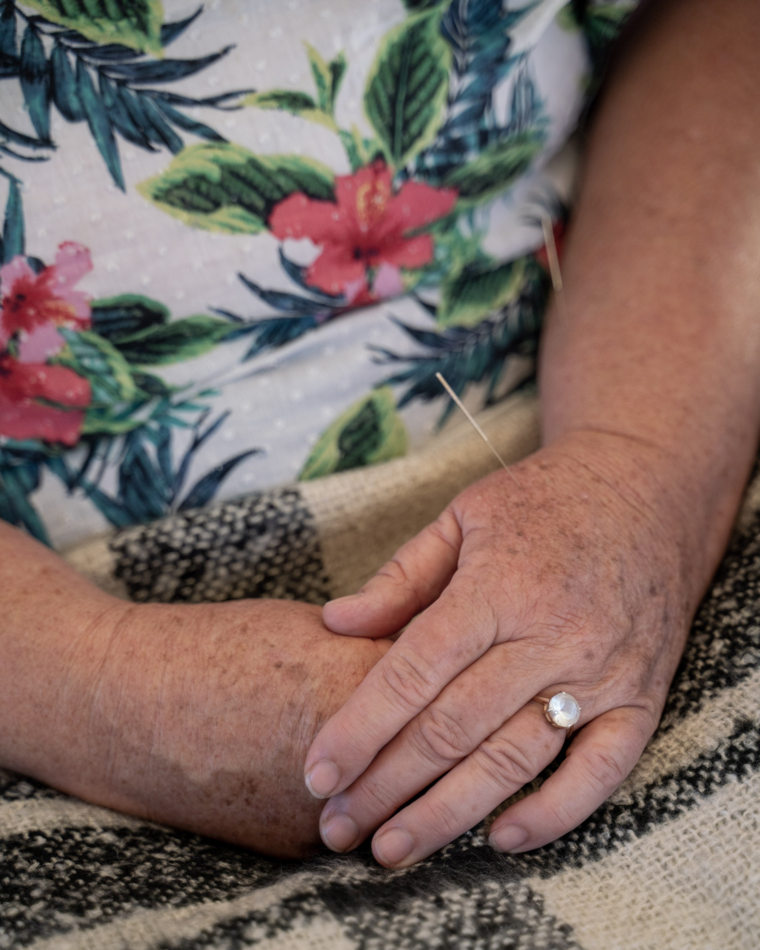 Acupuncture practice